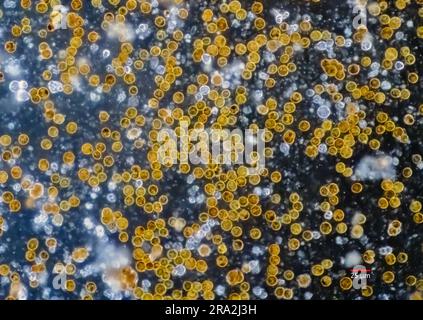 Zooxanthellae aus einer weichen Koralle (wahrscheinlich Sinularia sp.). Die einzelnen Zellen haben einen Durchmesser von 10-12 µm. Stockfoto