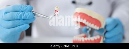 Zahnarzt-Haltezahn mit Pinzette und Kiefermodell Stockfoto