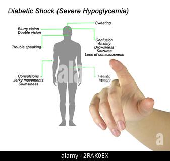 Diabetischer Schock (Schwere Hypoglykämie) Stockfoto