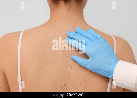 Dermatologe, der das Muttermal des Patienten auf beigefarbenem Hintergrund untersucht, Nahaufnahme Stockfoto