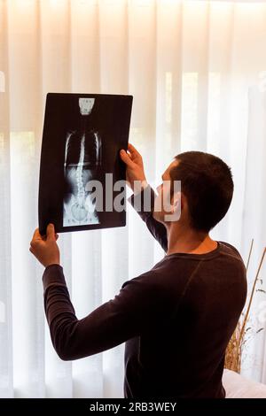 Bild eines Therapeuten, der ein Röntgenbild für eine Fallstudie eines Skoliosepatienten analysiert. Behandlung und Therapien zur Verbesserung des Patientenzustands. Stockfoto
