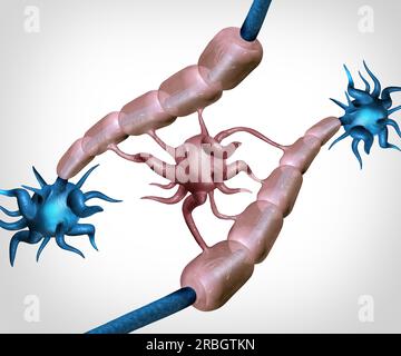 Oligodendrozyten und myelinierende Zellen als Alzhiemer und Multiple Sklerose oder MS-assoziierte Autoimmun- und Neurodegeneration mit gesundem Nerv und Myeli Stockfoto