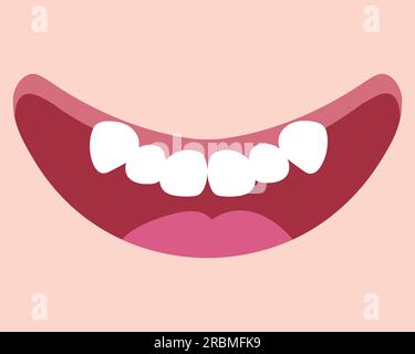 Karikatur lächelt Mund mit Zähnen quetschen. Doppelzahn. Anormaler Eruption. Süßes, handgezogenes Lächeln. Vektordarstellung Stock Vektor