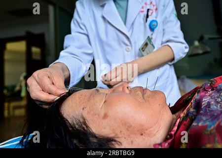 QINGZHOU, CHINA - 11. JULI 2023 - Ein Mediziner gibt Akupunkturbehandlung für einen Bürger in der Rehabilitationsabteilung des traditionellen chinesischen ME Stockfoto