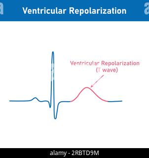 Ventrikuläre Repolarisation, T-Welle. Das QT-Intervall des EKGs. Der Herzzyklus. EKG eines Herzens bei normalem Sinusrhythmus. Ressourcen für Lehrer Stock Vektor