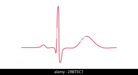 Ventrikuläre Repolarisation, T-Welle. Das QT-Intervall des EKGs. Der Herzzyklus. EKG eines Herzens bei normalem Sinusrhythmus. Stock Vektor