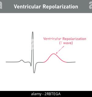 Ventrikuläre Repolarisation, T-Welle. Das QT-Intervall des EKGs. Der Herzzyklus. EKG eines Herzens bei normalem Sinusrhythmus. Ressourcen für Lehrer und Stude Stock Vektor