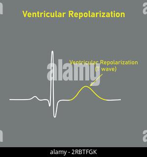 Ventrikuläre Repolarisation, T-Welle. Das QT-Intervall des EKGs. Der Herzzyklus. EKG eines Herzens bei normalem Sinusrhythmus. Ressourcen für Lehrer und Stude Stock Vektor