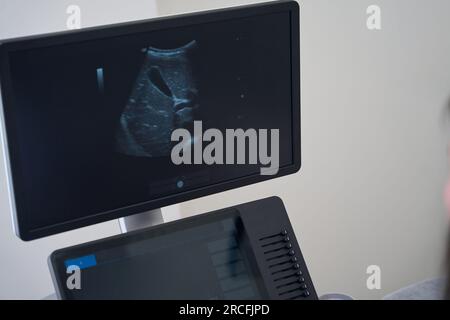 Monitor des Ultraschallgerätes mit dem Bild innerer Organe Stockfoto