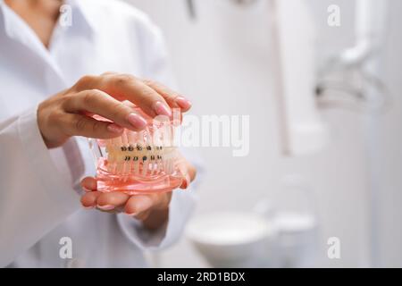 Nahaufnahme einer unkennbaren Kieferorthopädie-Ärztin im weissen Mantel mit menschlichem Kiefer-Layoutmodell mit Metallzahnspange in der Zahnheilkunde Stockfoto