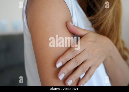 Junge Frau mit einer Narbe auf der Haut ihres Arms Stockfoto