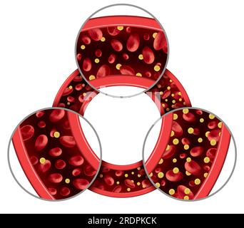 Glukose im Blut als Symbol für Hypoglykämie und Hyperglykämie oder normale Glukosespiegel als Diabetes oder diabetisches Symbol für niedrigen oder hohen Blutzucker Stockfoto