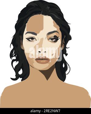 Illustration einer schwarzen Frau mit Hypopigmentierung der Gesichtshaut (Vitiligo) Stock Vektor