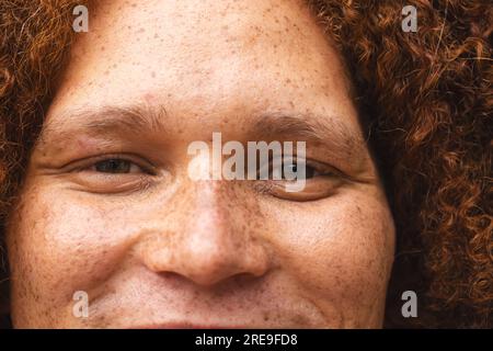 Porträtaufnahme eines glücklichen, birassischen Mannes mit roten Locken und Sommersprossen, die lächeln Stockfoto