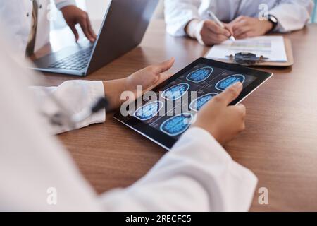 Arzt, Tablet-Bildschirm und Hände einer Person mit Gehirn-Scan-MRT, Tumorbefunden und Beratung zu digitalen Röntgendaten. Nahaufnahme-Teamarbeit, Radiologie Stockfoto