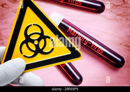 FOTOMONTAGE, Hand hält Biogefährdungszeichen vor Blutentörmlichkeiten mit der Aufschrift Marburg-Virus Stockfoto