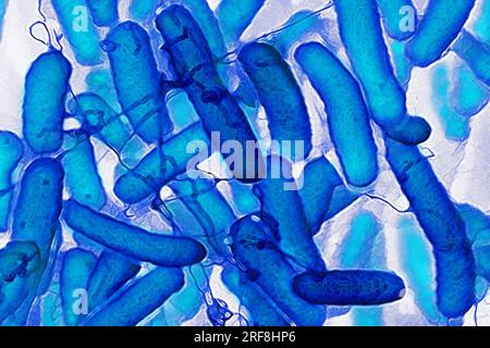 Escherichia coli (Darmbakterien, die sich im Verdauungstrakt von Menschen und Warmblütern befinden, sind die Ursache für Lebensmittelvergiftungen. Stockfoto