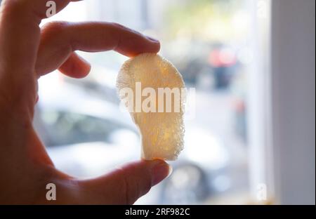 Virusinaktiviertes Knochentransplantat, hergestellt in einer Gewebe- und Zellbiobank. Stockfoto