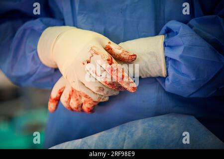 Blutbefleckte Operationshandschuhe in einer orthopädisch-chirurgischen Abteilung eines Krankenhauses. Stockfoto