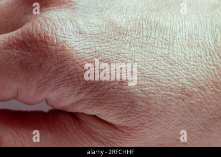 Nahaufnahme der zerknitterten Haut an der Hand eines älteren Mannes mit einigen Läsionen aktinischer Keratose oder Sonnenflecken. Die Konsistenz der menschlichen Haut. Stockfoto