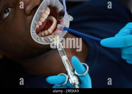 Nahaufnahme-Stomatologe, der beim afroamerikanischen Mann Mo eine Narkosespritze in das Zahnfleisch um den Zahn herum macht, während die Krankenschwester den Mundspiegel und die Absaugvorrichtung hält Stockfoto