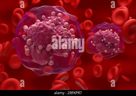 Akute lymphoblastische Leukämie (ALLE) Krebszellen im Blutfluss - Nahaufnahme Ansicht 3D Abbildung Stockfoto