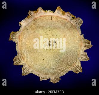 Eucidaris metularia, der zehnköpfige Seeigel. Wirbelsäule TS. Photomikrograph Stockfoto