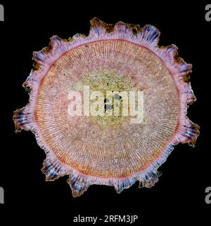 Eucidaris metularia, der zehnköpfige Seeigel. Wirbelsäule TS. Photomikrograph Stockfoto