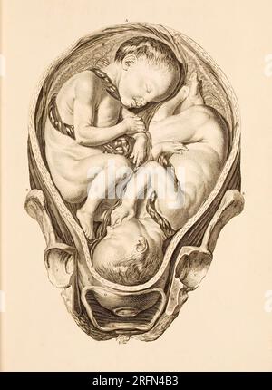 Eine Illustration von Zwillingen in utero aus Einem Satz anatomischer Tische, mit Erläuterungen und einer Abkürzung der Hebammenpraxis von William Smellie, 1754. Stockfoto