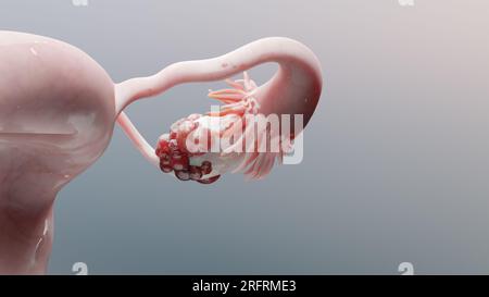 Bösartiger Ovarialtumor, Anatomie des weiblichen Uterus, Fortpflanzungssystem, Krebszellen, Ovarialzysten, Gebärmutterhalskrebs, wachsende Zellen, gynäkologische Erkrankungen Stockfoto