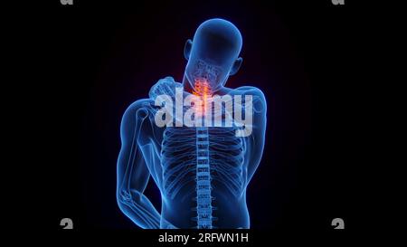 Nackenschmerzen, Illustration Stockfoto