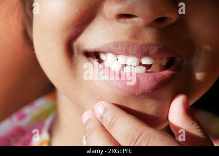 Nahaufnahme einer gebratenen Lippe Stockfoto