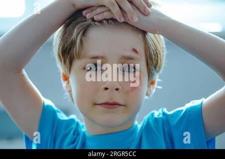 Porträt eines Kindes mit Kratzern nach dem Sturz auf sein Gesicht Stockfoto