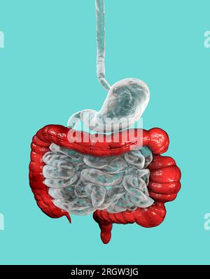 Reizdarmsyndrom, Illustration Stockfoto
