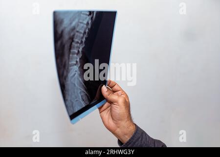 Ein Arzt in einem weißen Fell schaut auf eine Röntgenaufnahme der Knochen eines Patienten. Stockfoto