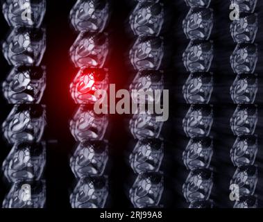 MRT Herz oder Herz-MRT ( Magnetresonanztomographie ) des Herzens zur Diagnostik der Herzkrankheit. Stockfoto