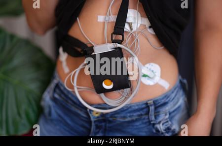 Frau mit Holter-Monitor zur täglichen Überwachung von Elektrokardiogramm und Blutdruck. Stockfoto