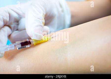 Nahaufnahme einer Krankenpflegehand, die einem Patienten intravenös ein Arzneimittel verabreicht. Intravenöse Tropfkatheterinjektion in den Patientenarm. Selektives Fokussieren Stockfoto