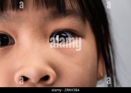 Schöne Augen eines kleinen asiatischen Mädchens aus der Nähe. Kopfbild eines Mädchenauges mit überraschtem Ausdruck. Stockfoto