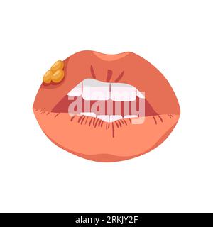 Lips with herpes. Infectious disease affecting mucous membranes Stock Vektor