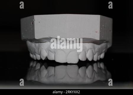 Zahntechniker-Modell-Orthesen-Wachszahn Stockfoto