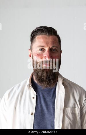 Junger kaukasischer Mann mit Rosazea, Couperose. Hautrötungen an Wangen, Stirn und Nase. Dermatologisches Problem. Stockfoto