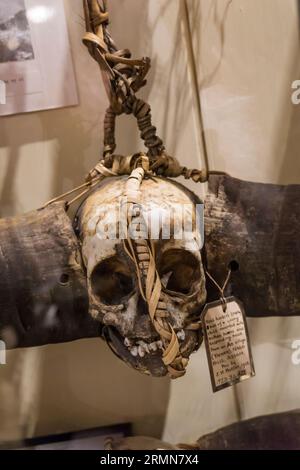 Kopfjäger-Trophäenschädel eines kleinen Kindes aus einem Ao-Dorf in Assam, indien. Pitt-Rivers Museum, Oxford. Stockfoto