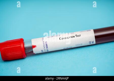Gerinnungstest dieser Test misst, wie gut das Blut gerinnt und zur Diagnose und Überwachung von Blutungsstörungen und zur Überwachung von Antikoagulanzien eingesetzt wird Stockfoto