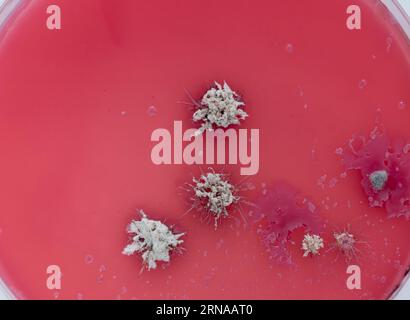 Kolonien von Mikroorganismen und Pilzen auf der Oberfläche eines Agar-Nährmediums in einer Petrischale Stockfoto