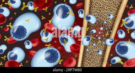 Multiples Myelomkonzept und Plasmazellkarzinom als Krebswachstum im Knochenmark. Stockfoto