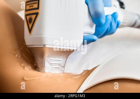Junge Frau im Bikini, die Laserhaarentfernung an der Achselhöhle bekommt, Nahaufnahme. Stockfoto