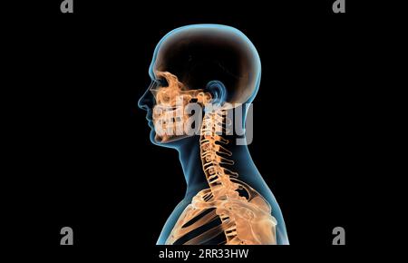 Seitenansicht der Halswirbelsäule bei Wirbelsäulenverletzung und Schmerzen Stockfoto
