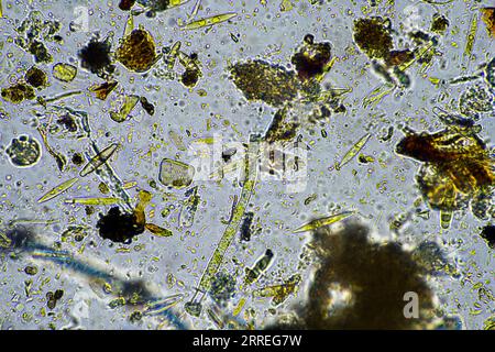 Bodenmikroorganismen aus der Nähe unter dem Mikroskop. In einem Boden aus einem Bauernhof Stockfoto