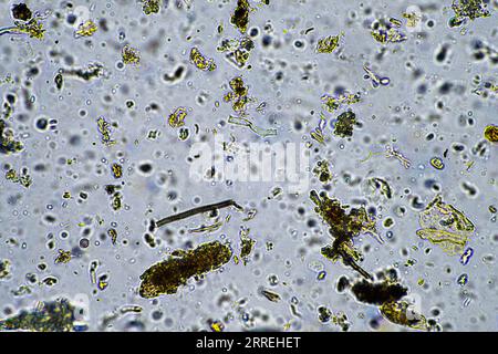 Bodenmikroorganismen aus der Nähe unter dem Mikroskop. In einem Boden aus einem Bauernhof Stockfoto
